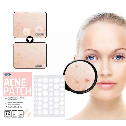 Hydrocolloid Acne Patches – Invisible Spot Treatment (360 Pcs)